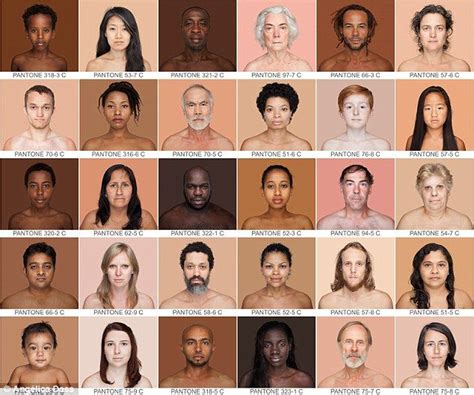 Opinion: It has everything to do with the color of our skin